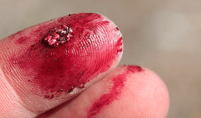 cochineal-extraction-natural-red-dye.webp__PID:c66c0a72-3b6d-4093-81a9-42a30cb5d956